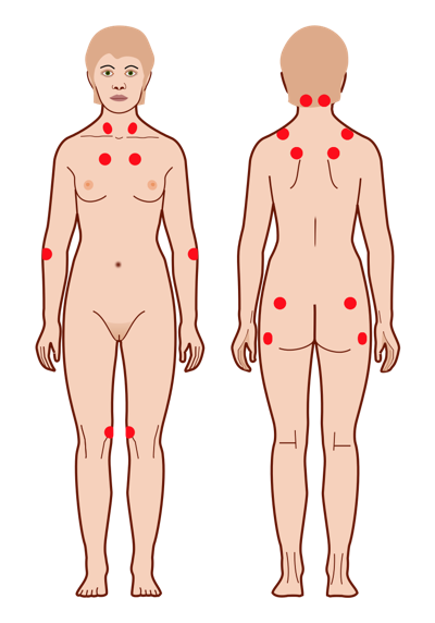 terapia alternativa para fibromialgia en tijuana