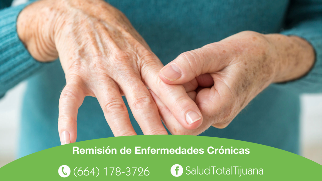 control de artritis en tijuana medicina alternativa